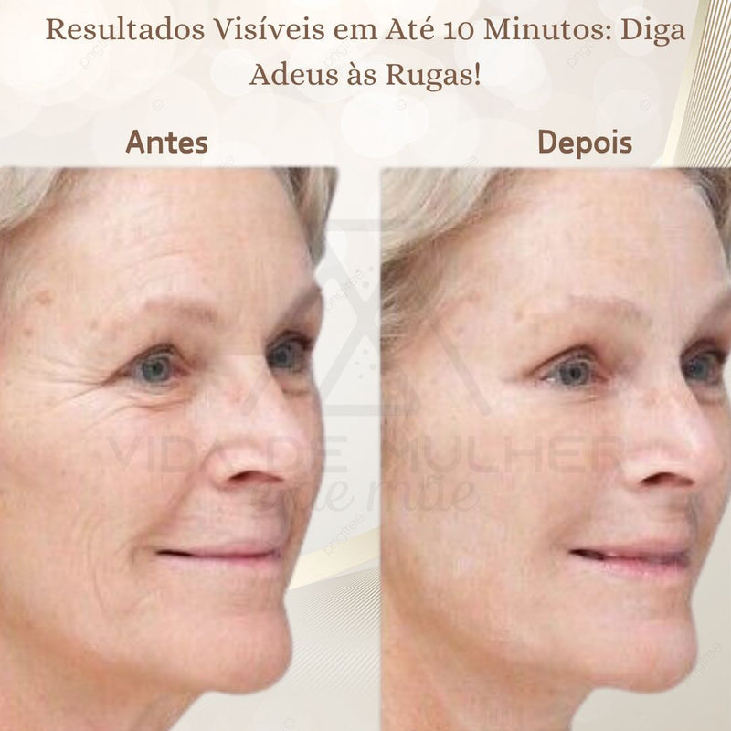 Creme Antirrugas,
Creme Facial,
Creme ácido hialurônico,
Creme para Rosto,